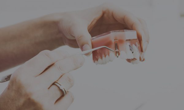 Replace missing tooth